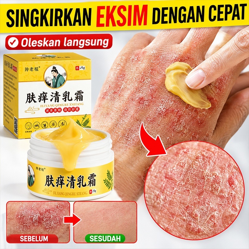 Salep China Gatal Salep Eksim Kering dan Gatal Salep Bayi Kulit Iritasi Obat Eksim Psoriasis Cream S