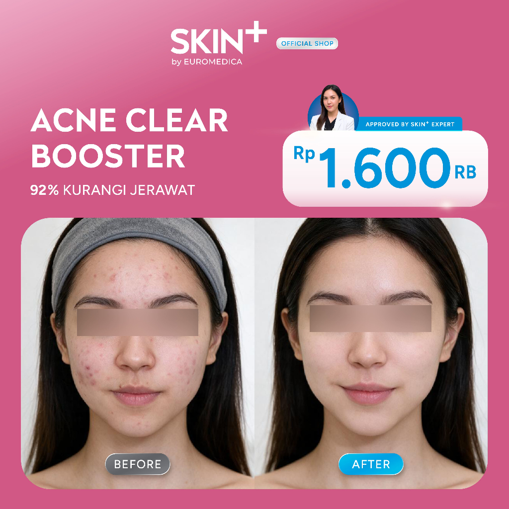 SKIN+ Clinic Acne Clear Booster Treatment - Perawatan Jerawat