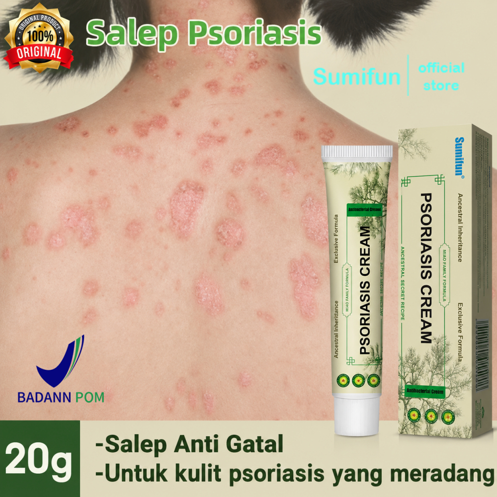 Salep Eksim Kering dan Gatal Salep Gatal Paling Ampuh Obat Gatal Selangkangan Salep Bayi Untuk Kulit
