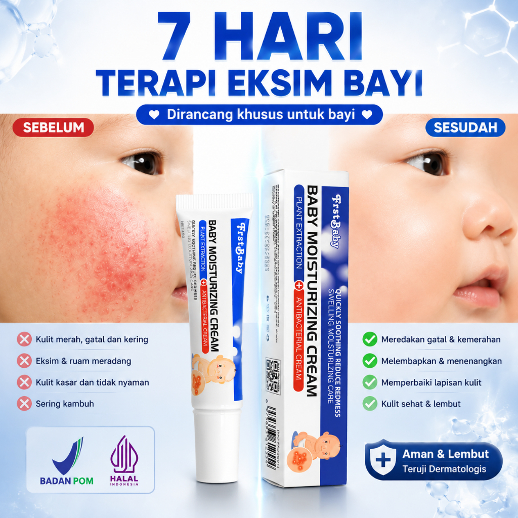 Salep Eksim Bayi Ampuh Meredakan Gatal Kulit Kemerahan Alergi Biang Keringat Ruam Popok Iritasi Kuli