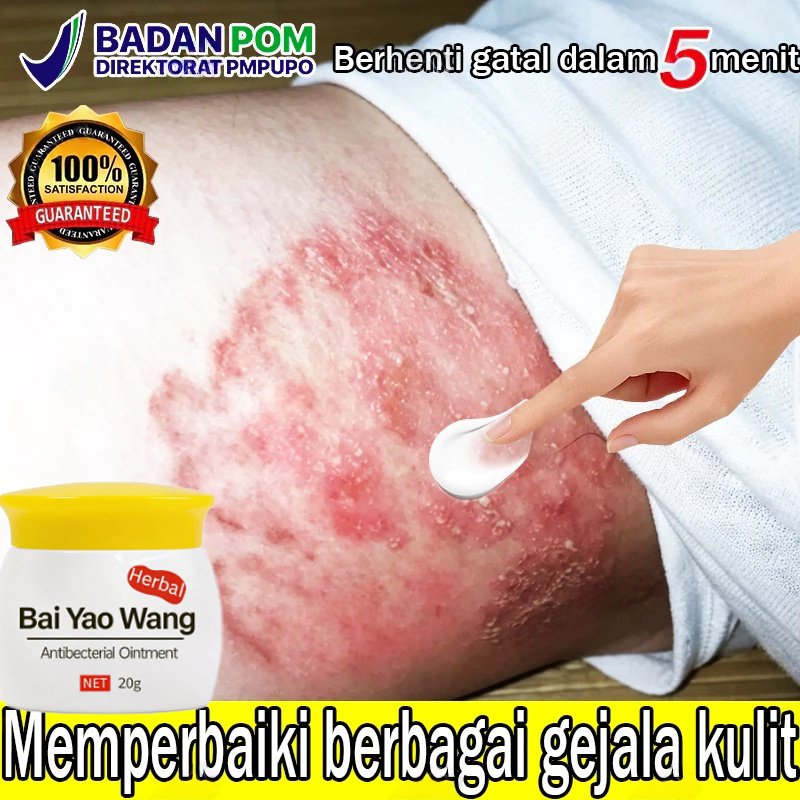 Salep Eksim Kering dan Gatal Salep Gatal China Paling Ampuh Obat Gatal Selangkangan Salep Bayi Untuk