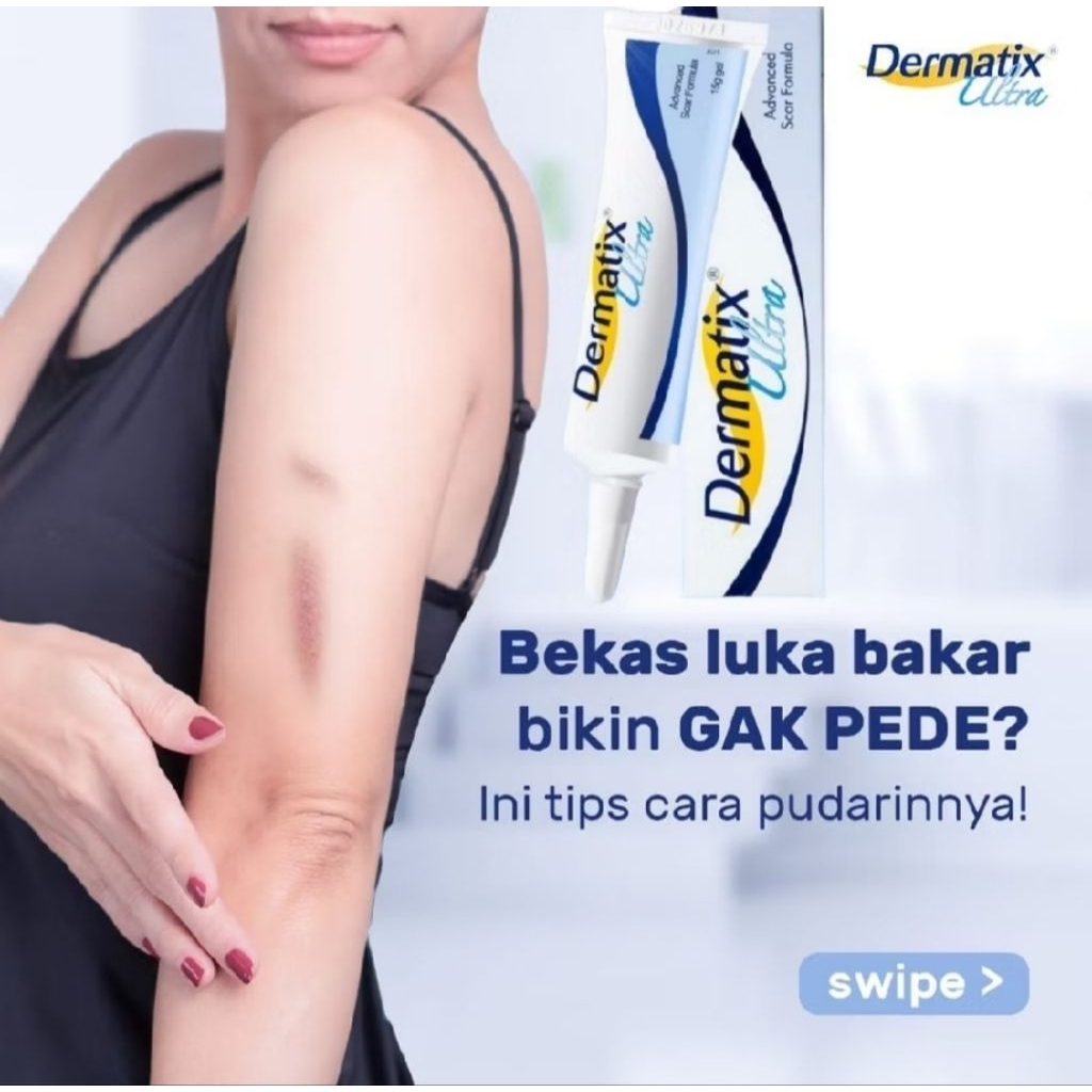 Dermatix Penghilang Bekas Luka Koreng Advanced Scar Gel/Dermatix Gel 15GR