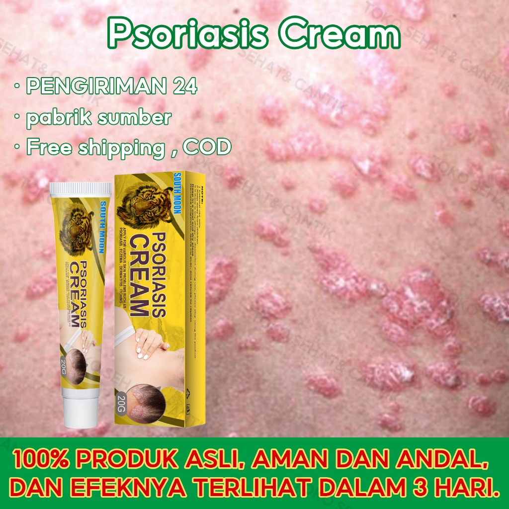South Moon Krim Psoriasis Herbal 20g Krim Gatal Salep Gatal Psoriasis Salep Kulit Jamur Salep Eksim 