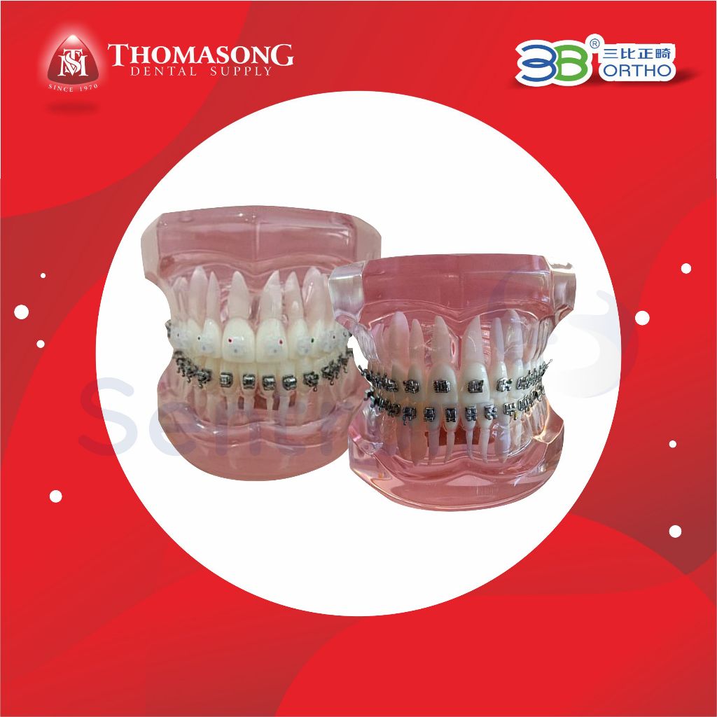 Model Gigi Ortho Dengan Macam-macam Bracket / Typodont - 3B Ortho