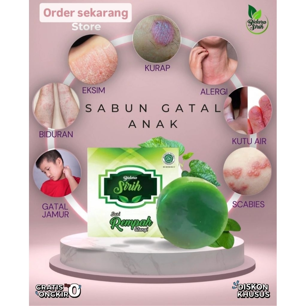 sabun gatal anak |salep gatal anak |gatal gatal |salep gatal anak |obat gatal anak| obat gatal | gat