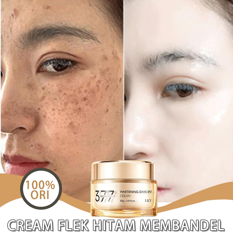 Salep flek hitam membandel pemutih wajah cepat 3 hari bpom marie skin lian cream flek original 30gwa