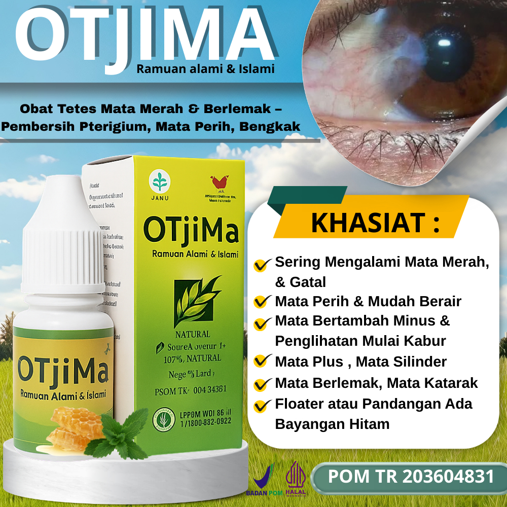 Obat Tetes Mata Merah & Berlemak – Pembersih Pterigium, Mata Perih, Bengkak & Penglihatan Berbayang