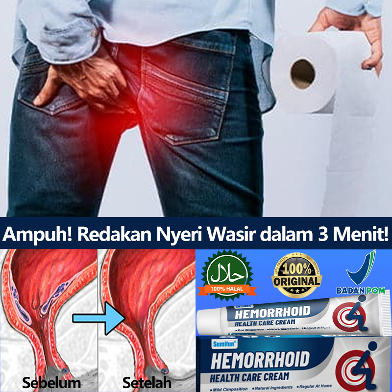 Salep ambeien paling ampuh Salep wasir gatal Salep wasir luar benjolan 20g Krim penghilang nyeri gat
