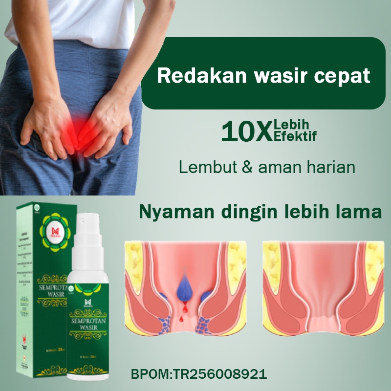 Salep ambeien paling ampuh Obat wasir Salep ambeyen paling ampuh original 30ml Salep wasir