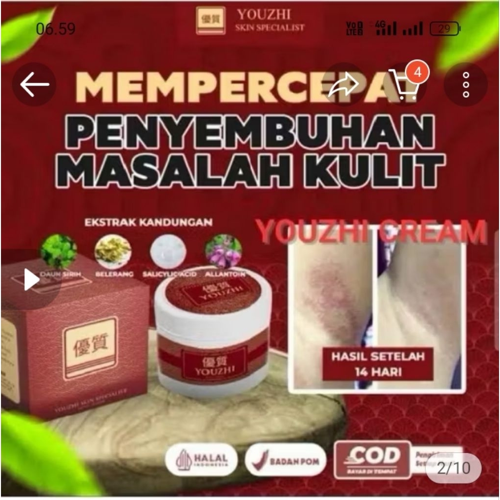 salep gatal youzi salep gatal biduran alergi kurap exzim jamur