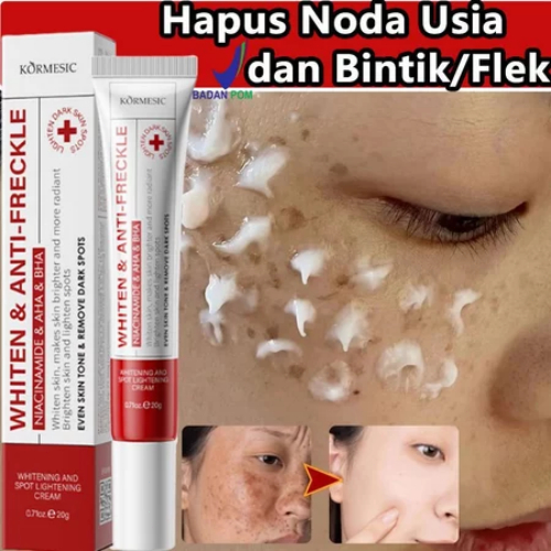 Cream flek hitam membandel bpom salep flek hitam membandel cream penghilang flek hitam 30g serum fle