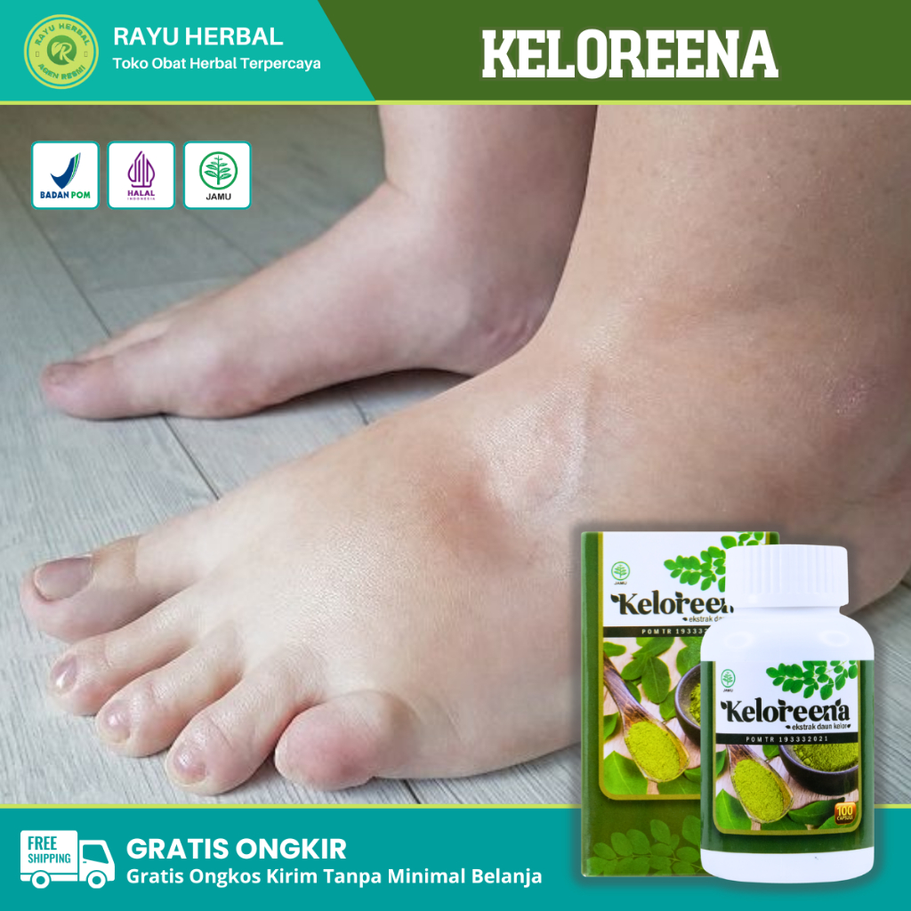 Obat Kaki Bengkak Diabetes Asam Urat Jantung dan Ginjal, Obat Kaki Bengkak Penumpukan Cairan, Obat D