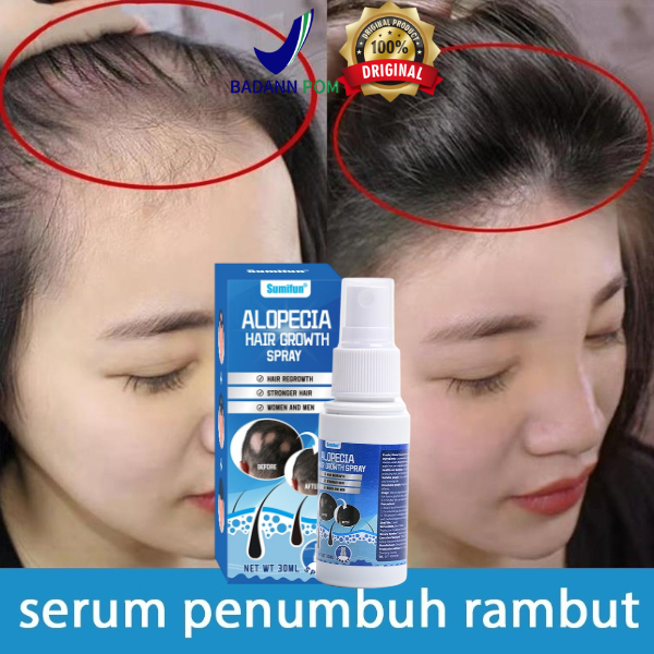 penumbuh rambut botak Serum Penumbuh Rambut 30 ml - Anti Rambut Rontok dan Menebalkan Rambut untuk b