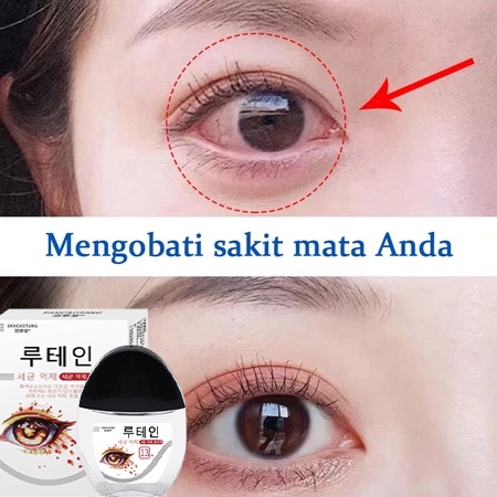 Tetes Mata Lutein Lutein eye drops Khusus untuk mata kuning dan bercak di mata Baik untuk anak-anak 