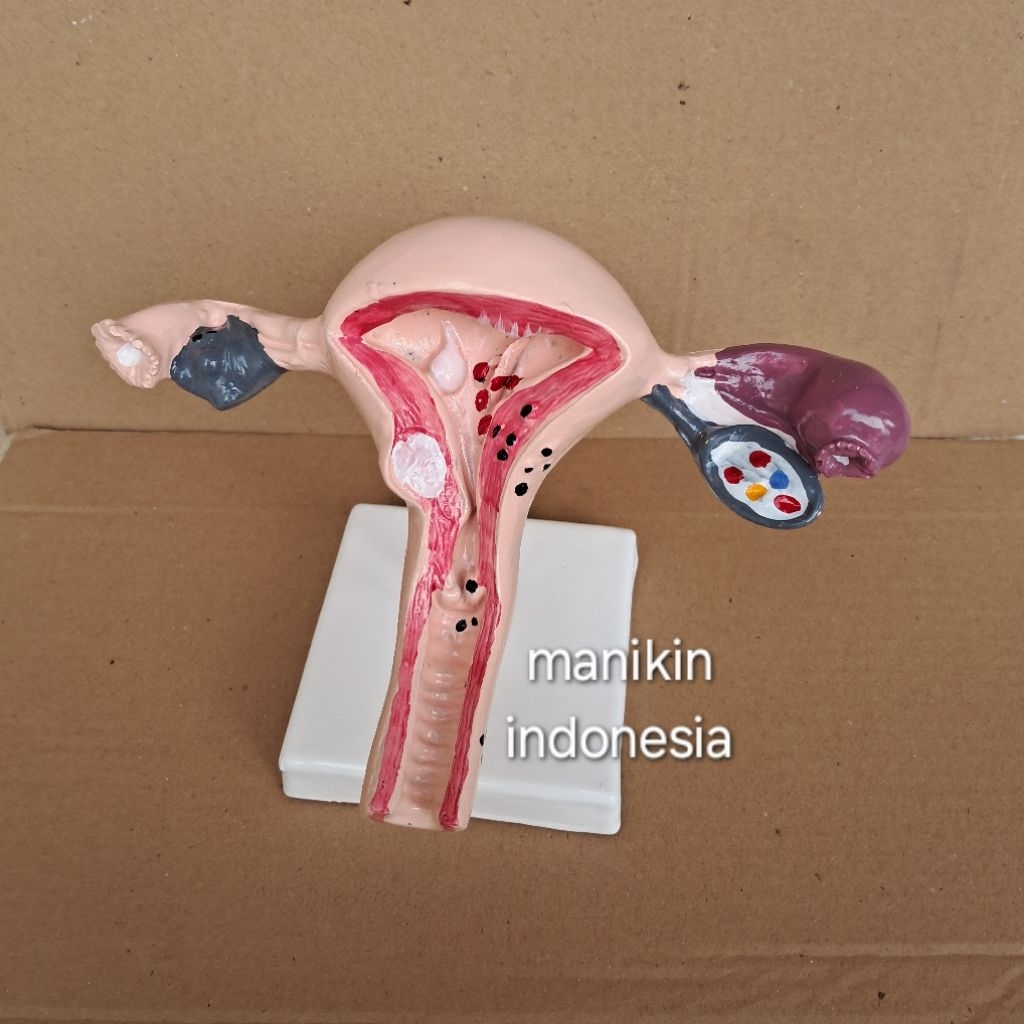 Phantom Manekin Uterus / Uterus Ovary Anatomical Model / Alat Peraga Pendidikan