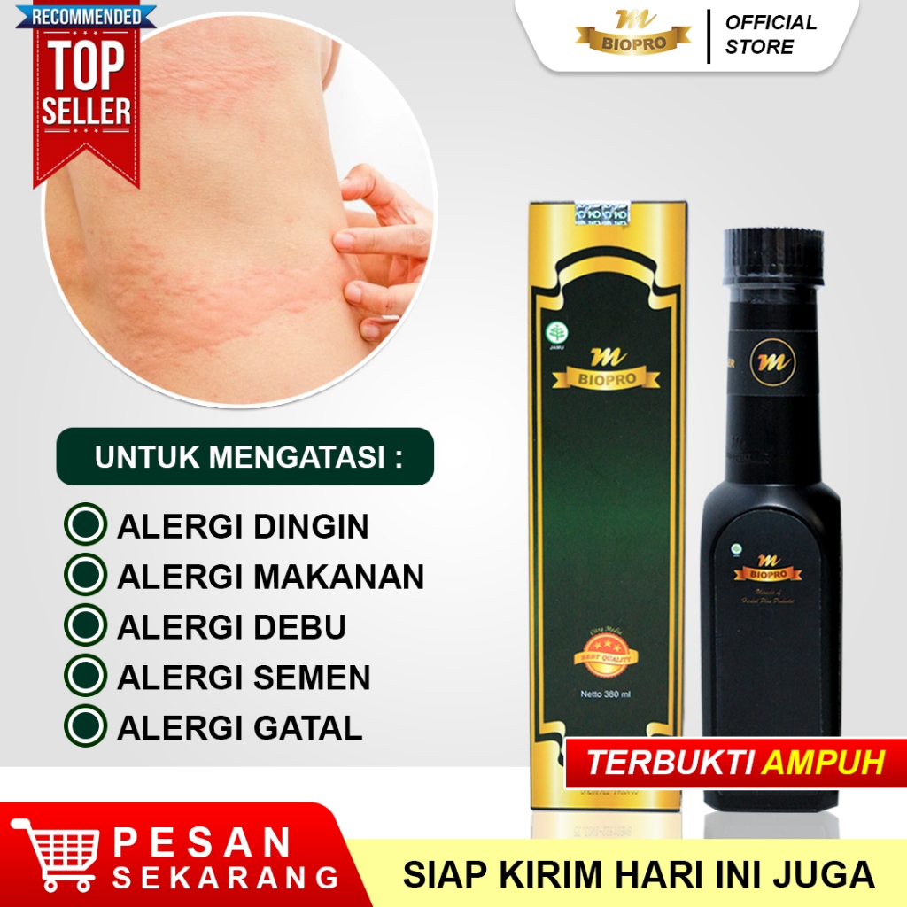 Obat Alergi Kulit Gatal, Alergi Dingin, Alergi Gatal, Alergi Makanan, Alergi Bersin, Alergi Seafood,