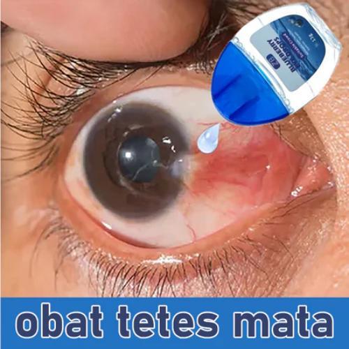 Obat Tetes Mata Obat Mata minus Tetes Mata minus Katarak Silinder Obat Mata Penurun minus 15ml