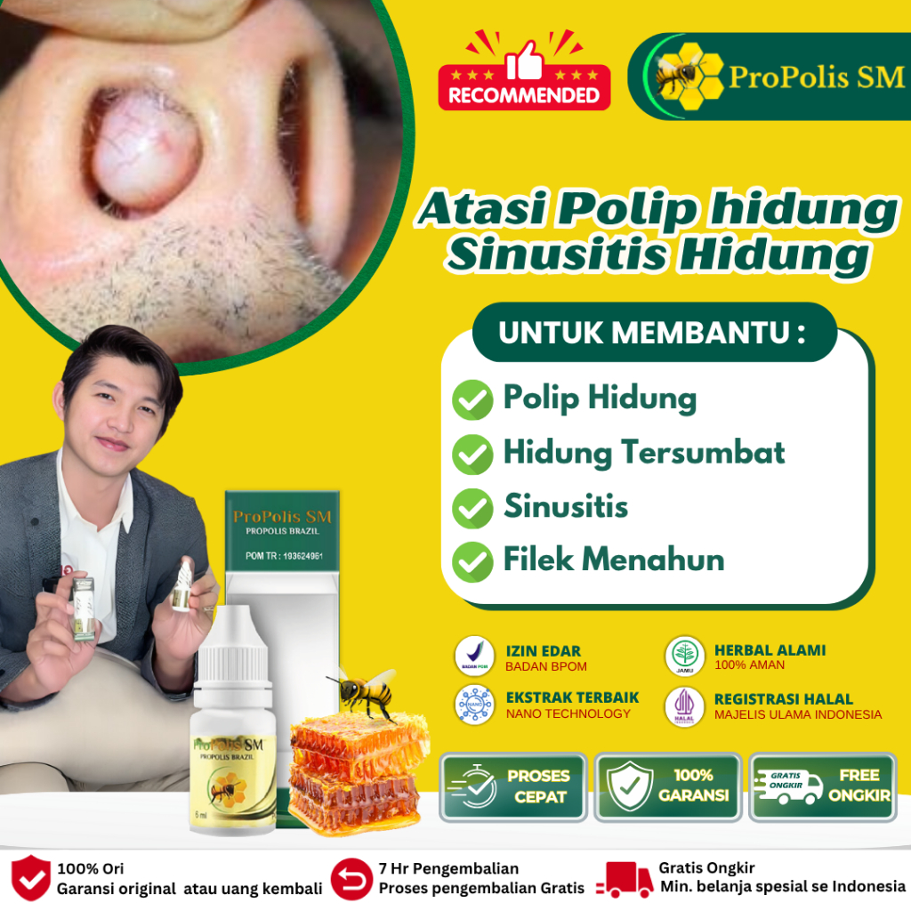 Propolis Sm - Obat Polip Hidung, Obat Benjolan Di Dalam Hidung, Obat Hidung Sakit Dan Bengkak, Obat 