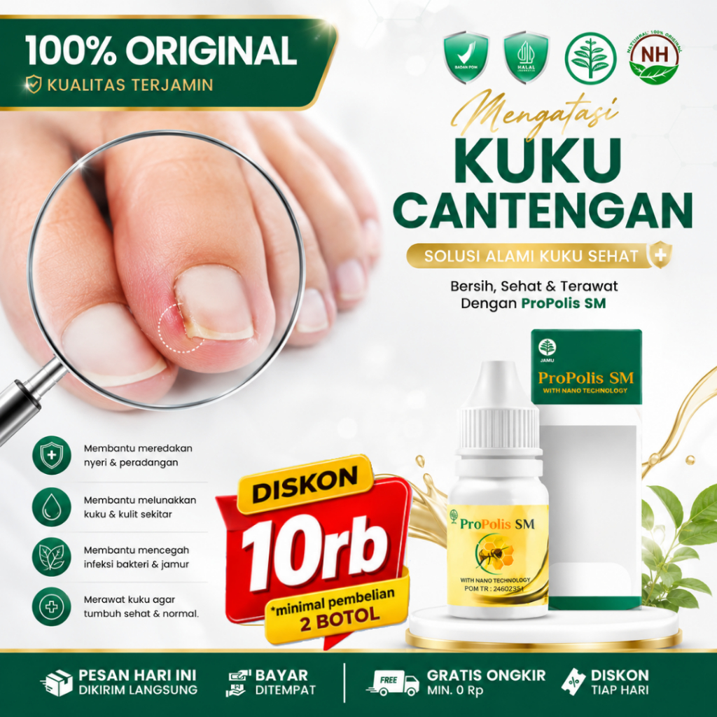 Propolis Sm Original - Obat Cantengan Jempol Kaki Bengkak - Obat Jamur Kuku Kaki - Obat Kuku Bengkak