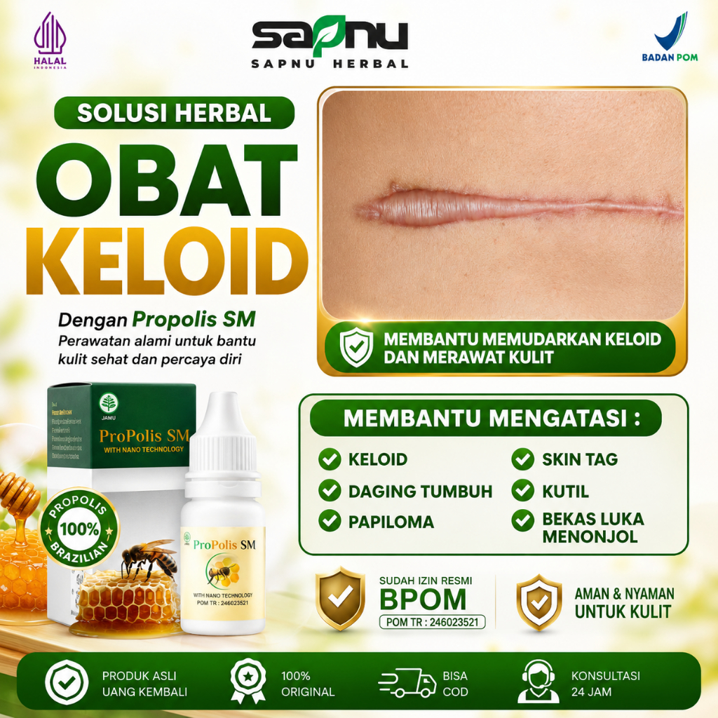Propolis Sm Obat Keloid, Obat Keloid Di Telinga, Obat Keloid Menonjol Tahunan, Obat Keloid Daging Tu