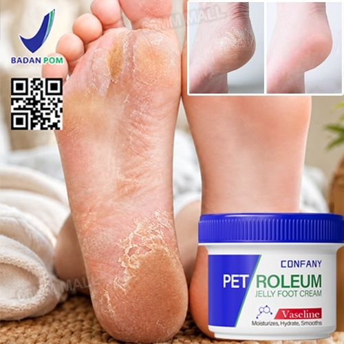 obat kaki pecah pecah Vaseline kaki pecah dan kering 50g salep kaki pecah2 paling ampuh obat tumit p