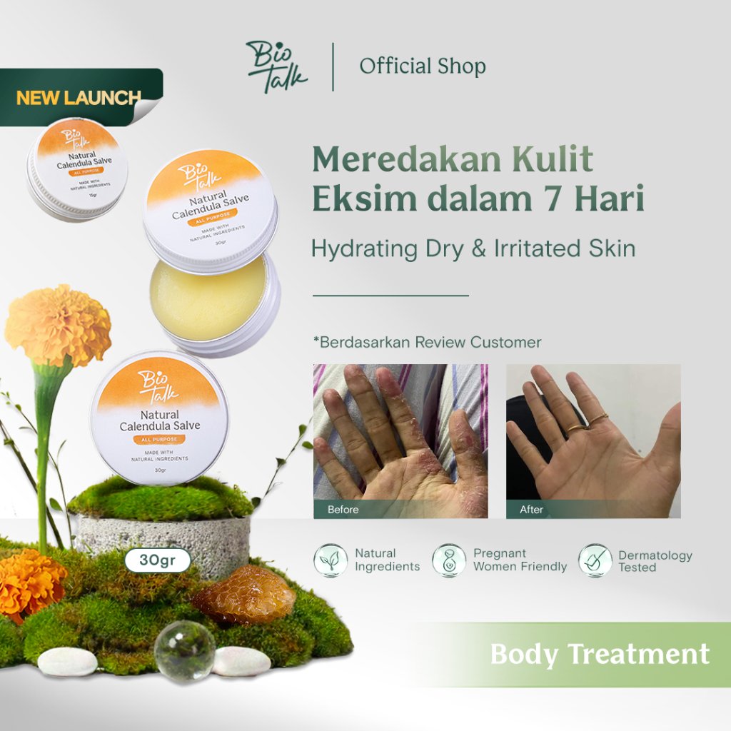 [FLASH SALE] Biotalk Natural Calendula Salve | No Steroid | Meredakan Kulit Eksim Psoriasis Sensitif