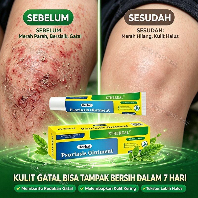 Oba Gatal Paling Ampuh Salep Gatel Jamur Kulit Salep Selangkangan Eksim Dan Jamur Obt Gatal Seluruh 
