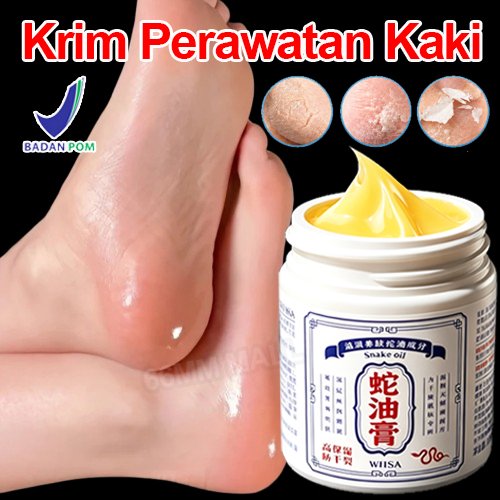 Salep Kaki Pecah2 Paling Ampuh Pelembab Kaki Kering Dan Pecah Salep Tumit Pecah Pecah Dan Kering Oba