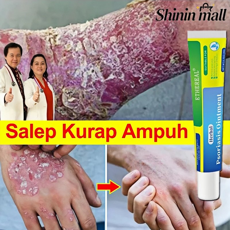 Salep Kurap Ampuh Cepat Hilang Salep Psoriasis Salep Eksim Kering Dan Gatal Obat Panu Kurap Onat Gat