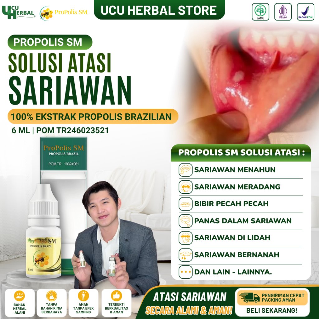 Obat Tetes Sariawan, Obat Sariawan di Bibir, Obat Panas Dalam Sariawan, Obat Penghilang Luka Sariawa