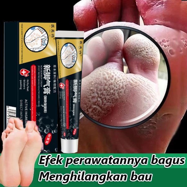 Antibacterial cream obat jamur kaki salep jamur kaki salep kaki rayapan dan bau salep kaki rayapan d