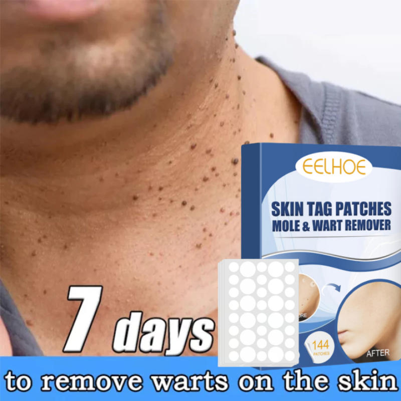EELHOE Skin Tag Patch 144PCS Plester Kutil Skin Tag Remover Patch Stiker Perawatan Kutil Leher Wajah