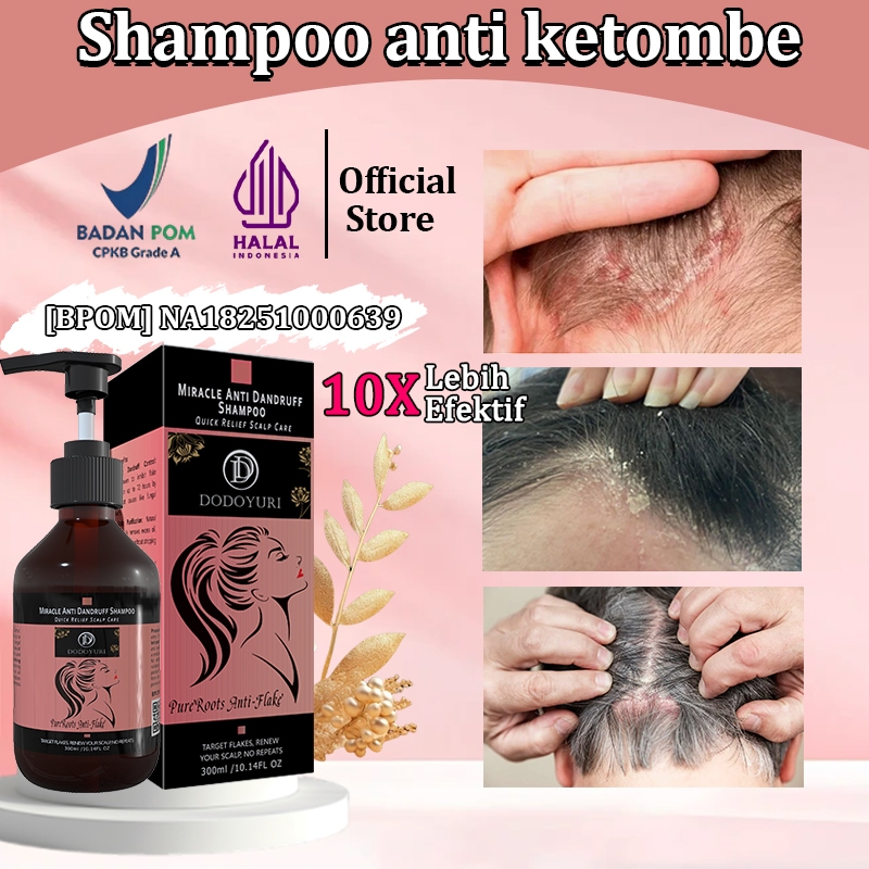 DODOYURI Shampoo anti ketombe Sampo penghilang ketombe Sampo anti gatal and ketombe 300ml Penghilang