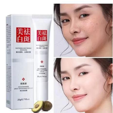 FUYAN SPOT WHITENING CREAM 20 G CREAMPEMUTIH PENGHILANG FLEK
