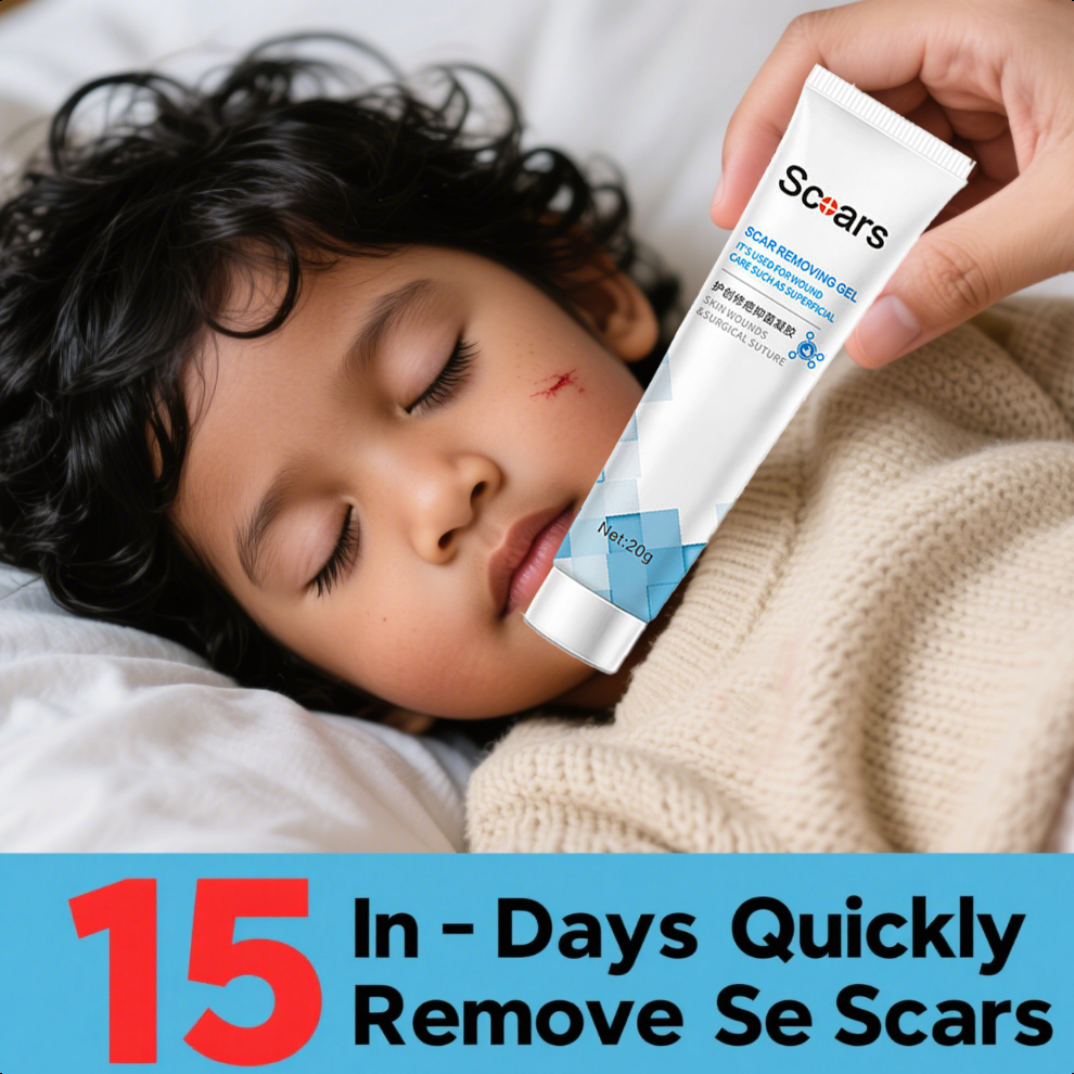 Penghilang Bekas Luka / 20gr Obat Bekas Luka Koreng / Salep Keloid-Cocok untuk anak-anak