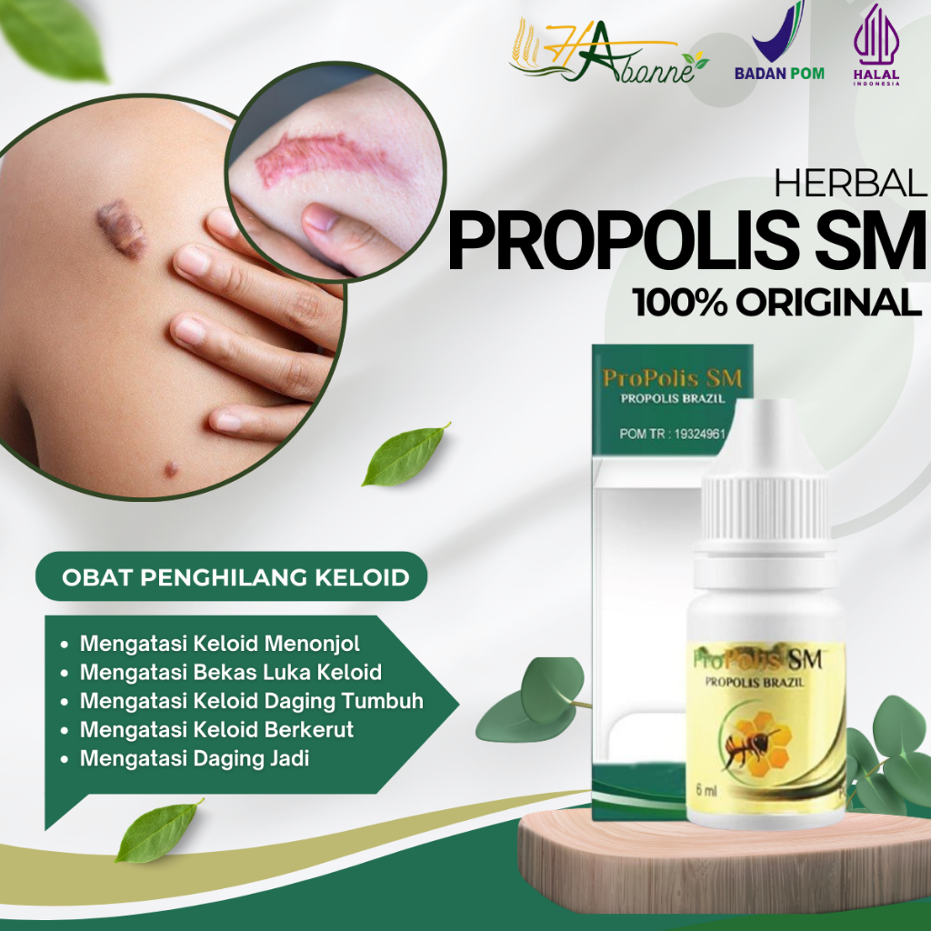 HAbonne - Obat Keloid Menonjol Tahunan, Bekas Luka Menonjol, Keloid Daging Tumbuh, Keloid Di Dada, P