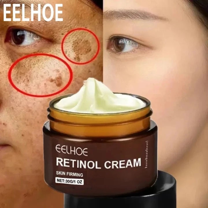 Eelhoe Retinol Cream Collagen Cream Cream Pemutih Wajah Anti Penuaan Pemutih Menghilangkan Kerut Waj