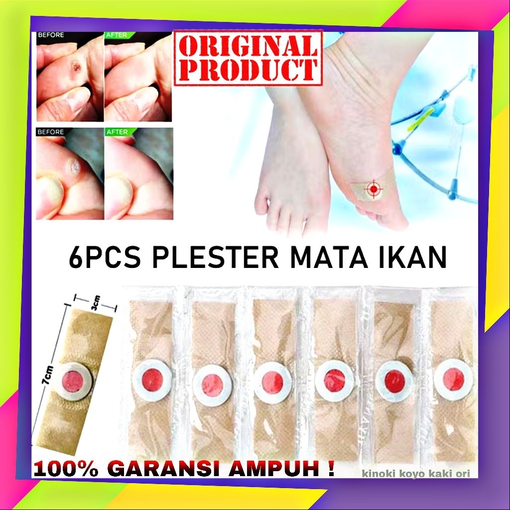 Plester kutil mata ikan isi 6 pcs koyo penghilang kutil dan mata ikan