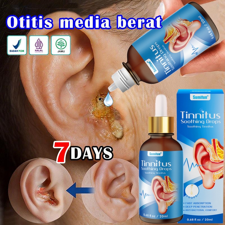Krim pelembap tubuh Obat Tetes Telinga Sediaan Tetes Telinga Radang Telinga Infeksi Telinga Curek-Be