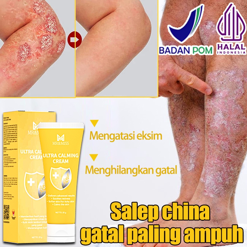 Salep china gatal paling ampuh obat gatal selangkangan Salep gatal selangkangan 0bat gatal gatal kul
