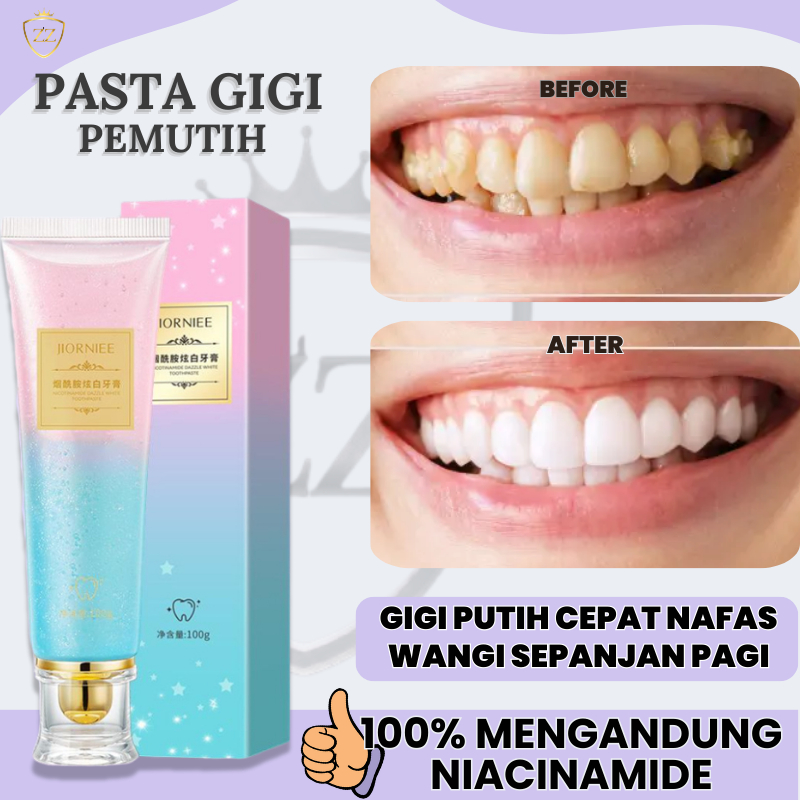 Odol Pemutih Gigi Dan Penghilang Karang Gigi | Pasta Gigi Pemutih Perontok Karang Gigi Paling Ampuh