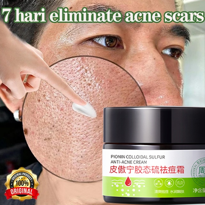 BPOM Salep jerawat dan bekas jerawat penghilang jerawat obat jerawat dan bekas jerawat penghilang be