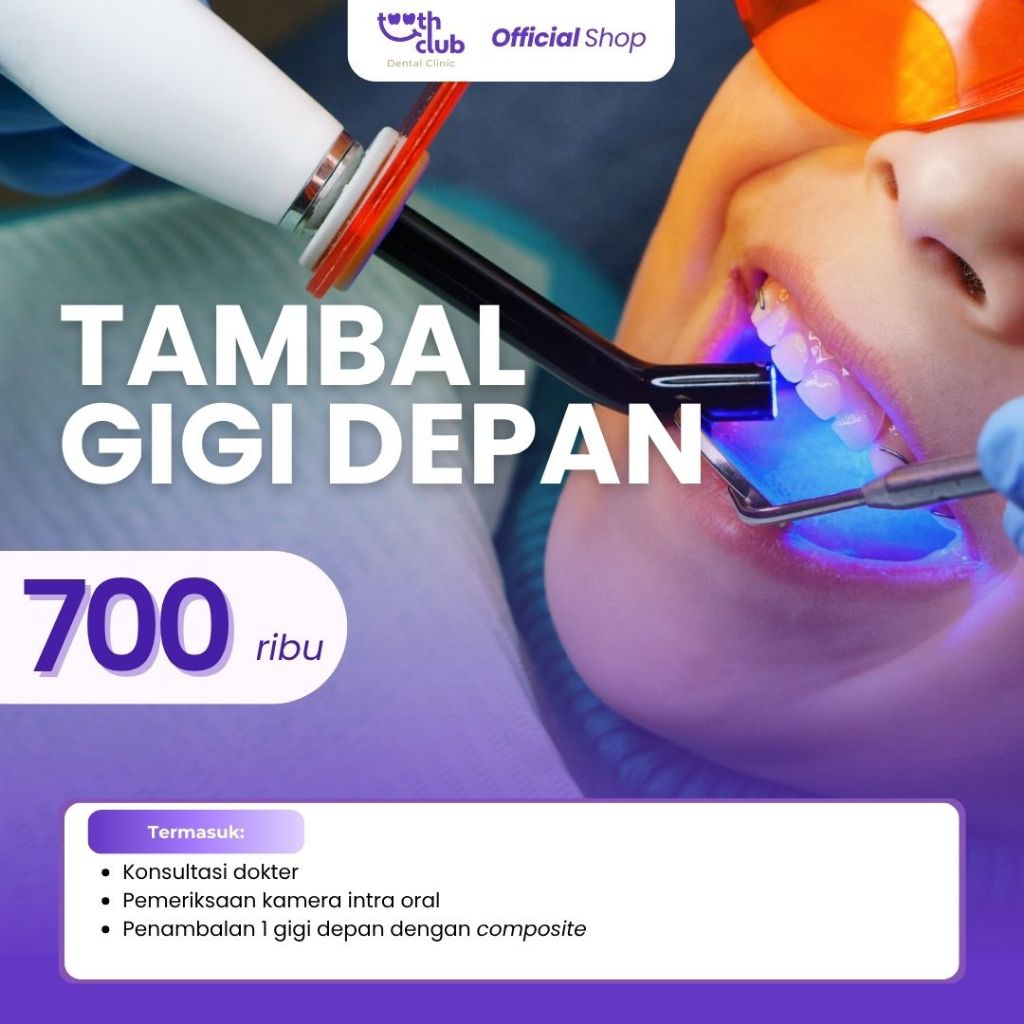 Tambal Estetik Gigi Depan dengan Composite