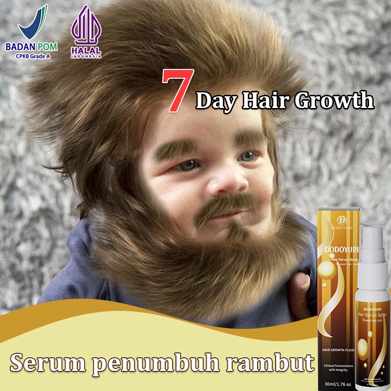 【BPOM】Obat penumbuh rambut Penumbuh rambut cepat Serum penumbuh rambut 30ml rambut Kontrol minyak Sc