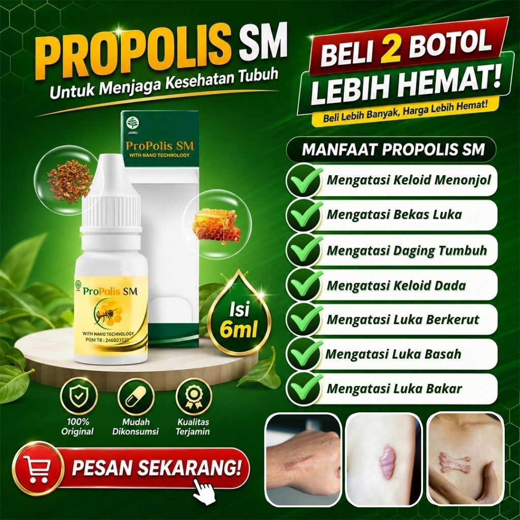 Obat Keloid Menonjol Bekas Luka Menonjol, Keloid Daging Tumbuh, Keloid Di Dada, Penghilang Keloid Be