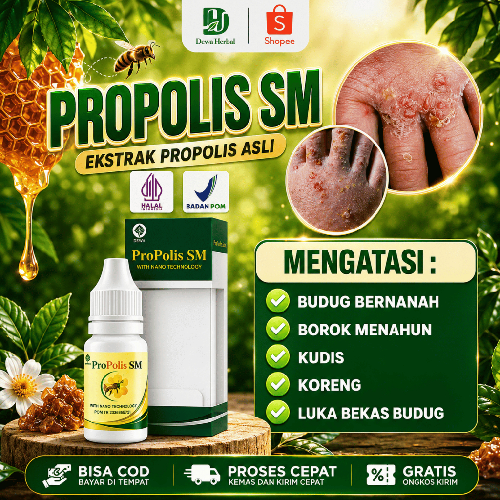 Obat Budug Anak Dewasa, Obat Budug Bernanah, Obat Borok Budug, Obat Penghilang Bekas Budug, Obat Bor