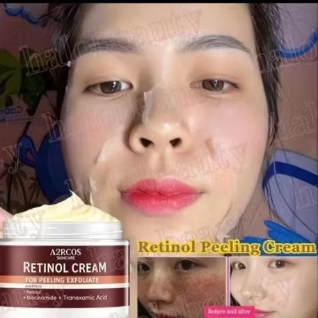 PEELLING RETINOL CREAM BPOMpeeling Booster exfoliasi Merontokkan Flek & Susah Putih BY A2RCOS