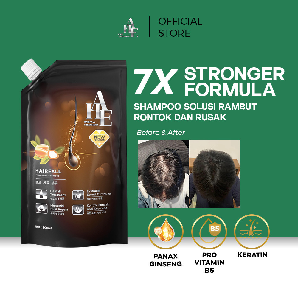AHE Hair Fall Treatment Shampoo 300 ML Sampo Penumbuh Rambut Rontok dan Anti Ketombe
