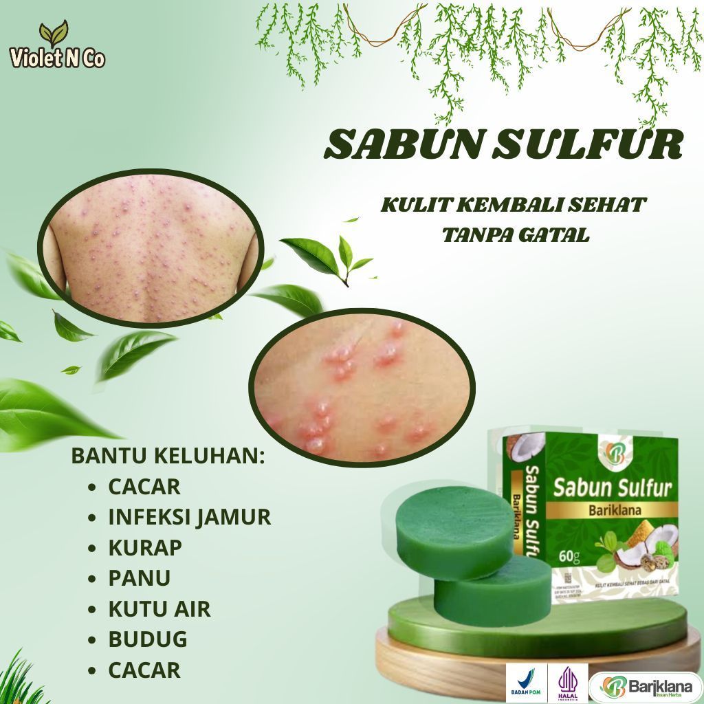 Sabun Sulfur - Obat Cacar Air, Obat Cacar Api, Obat Penghilang Bekas Cacar, Obat Herpes Kulit, Obat 