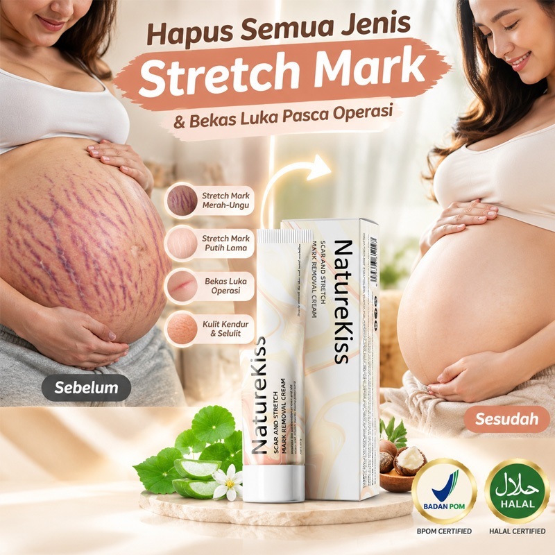 Krim Stretch Mark Cream Memudarkan Stretch Mark Merah Ungu & Putih Membandel Aman Bumil Busui Mengen